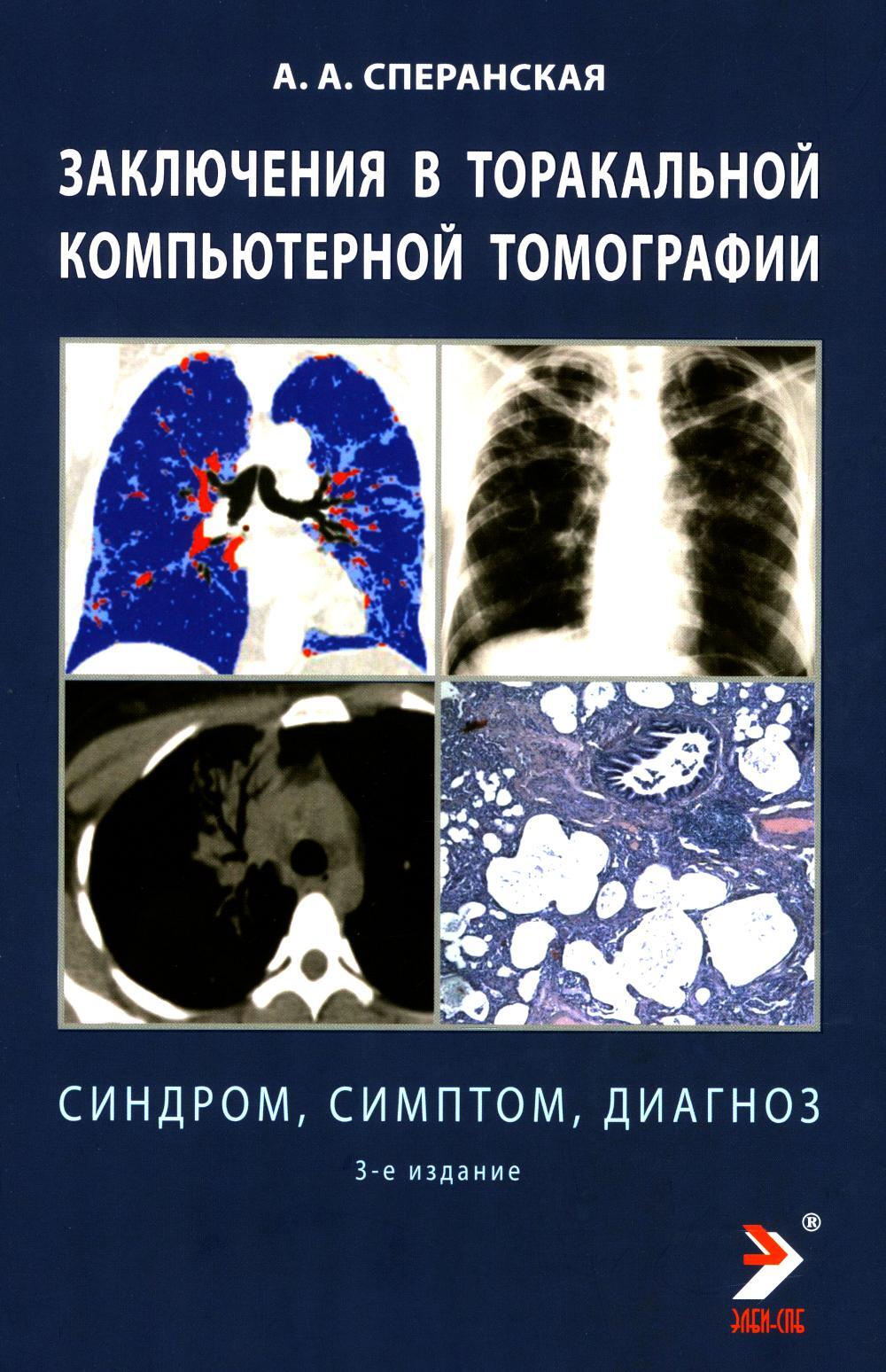 Заключение в торакальной компьютерной томографии. Симптом, синдром, диагноз. 3-е изд
