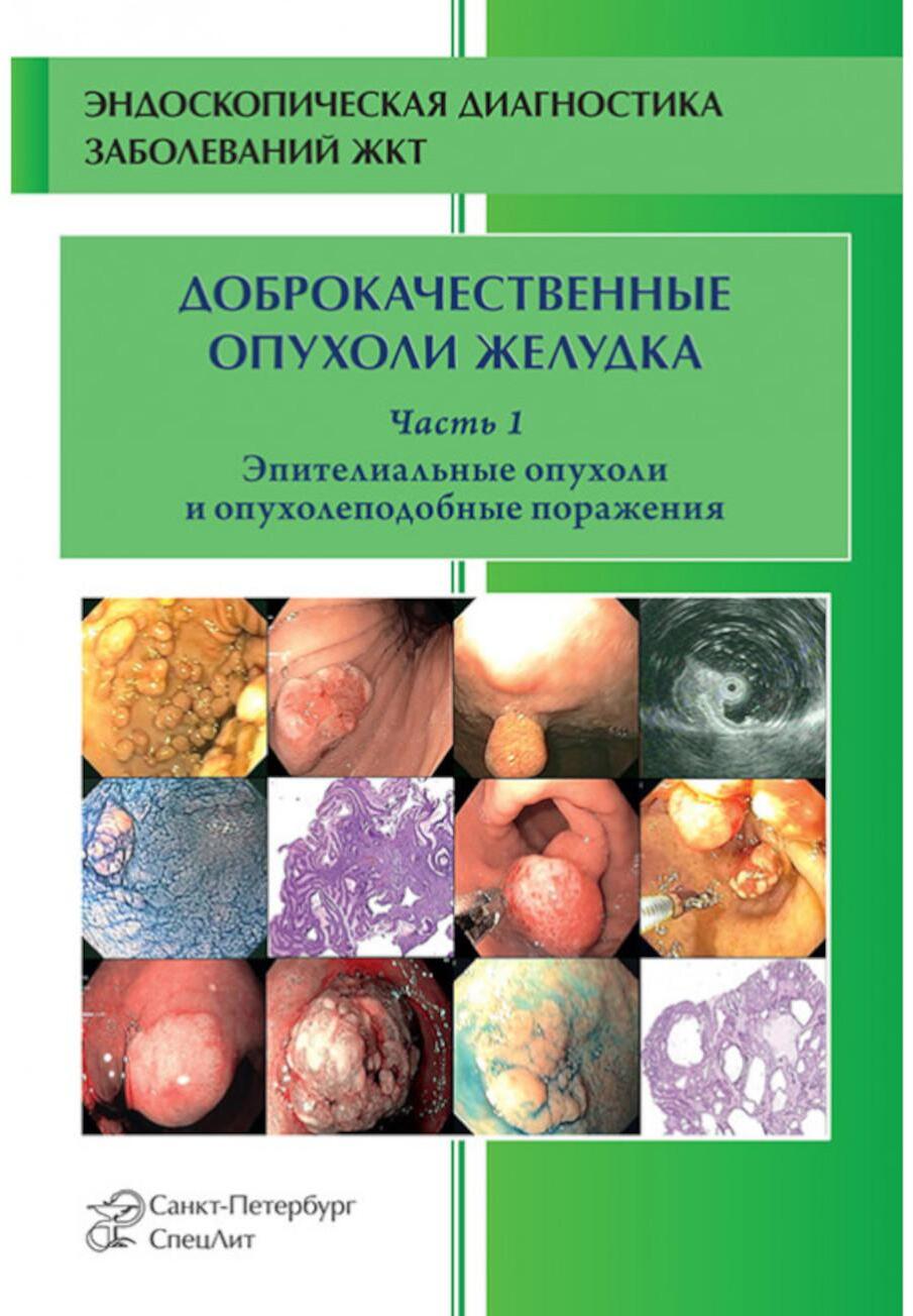 Доброкачественные опухоли желудка. Ч. 1: Эпителиальные опухоли и опухолеподобные поражения: Учебно-методическое пособие. 2-е изд., испр. и доп