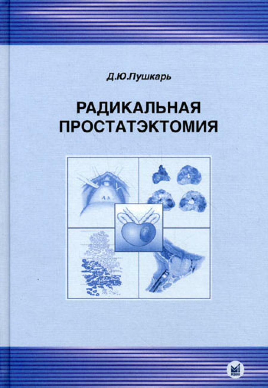 Радикальная простатэктомия. 3-е изд., без изм