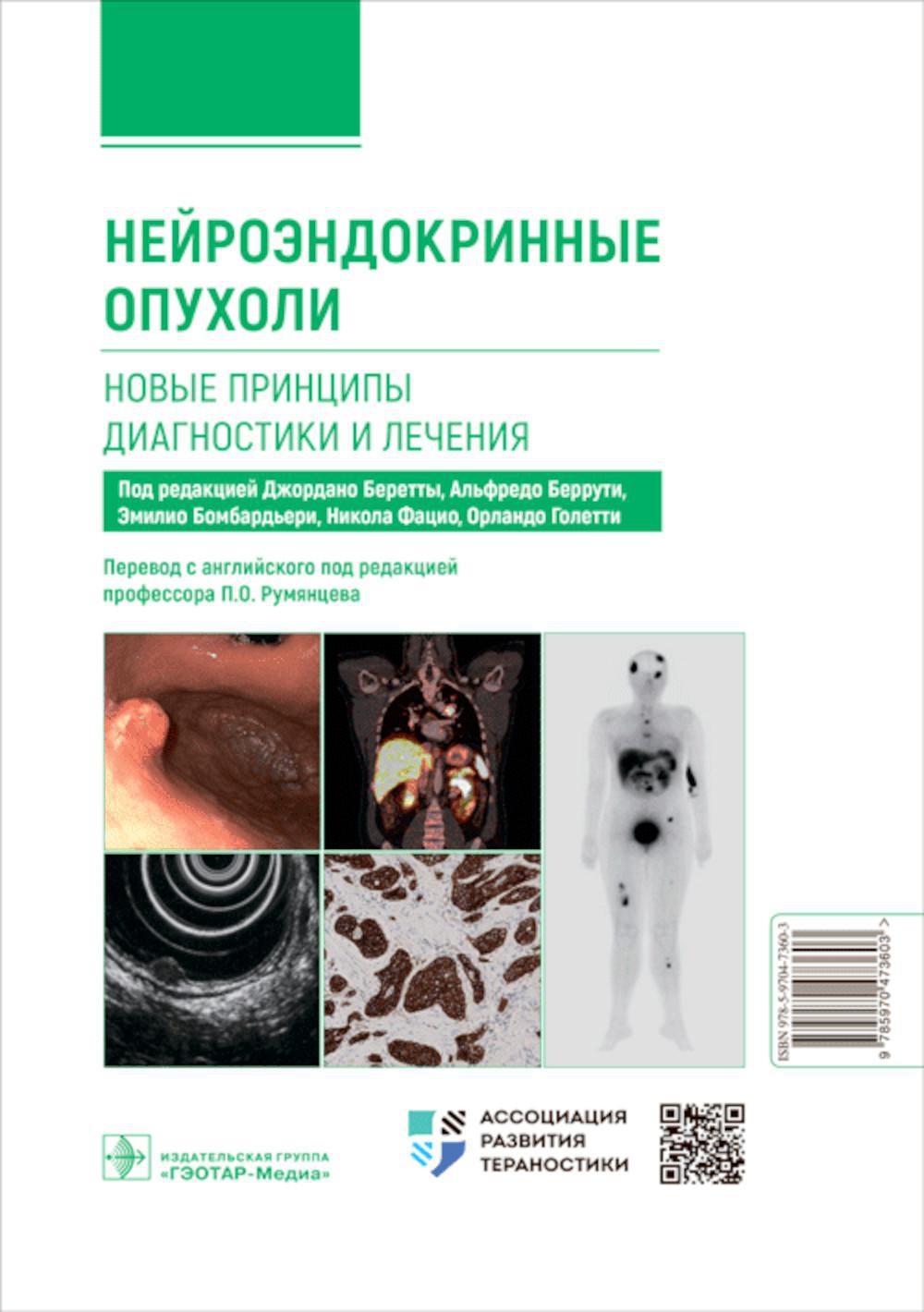 Нейроэндокринные опухоли. Новые принципы диагностики и лечения: руководство для врачей
