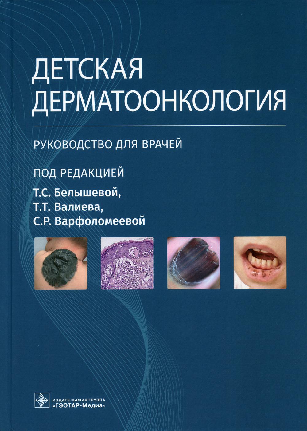 Детская дерматоонкология: руководство для врачей