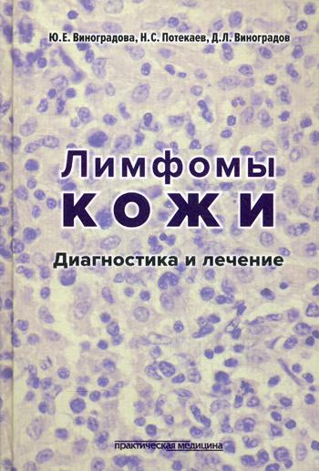 Лимфомы кожи: Диагностика и лечение