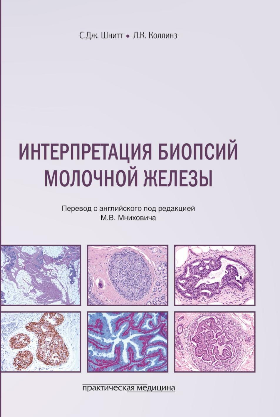 Интерпретация биопсий молочной железы