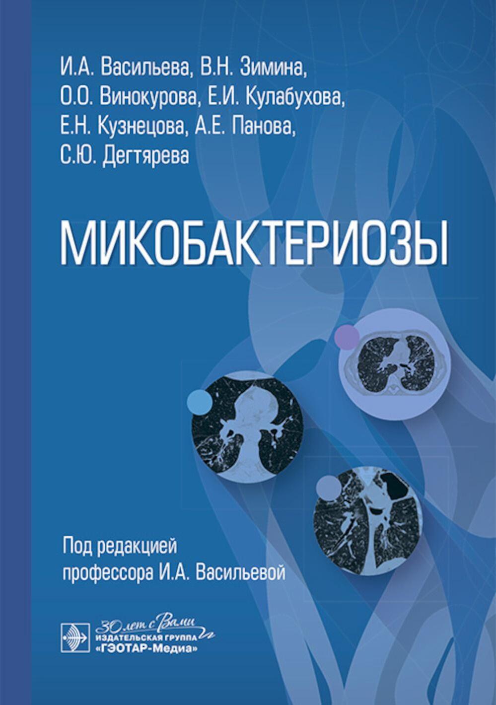 Микобактериозы