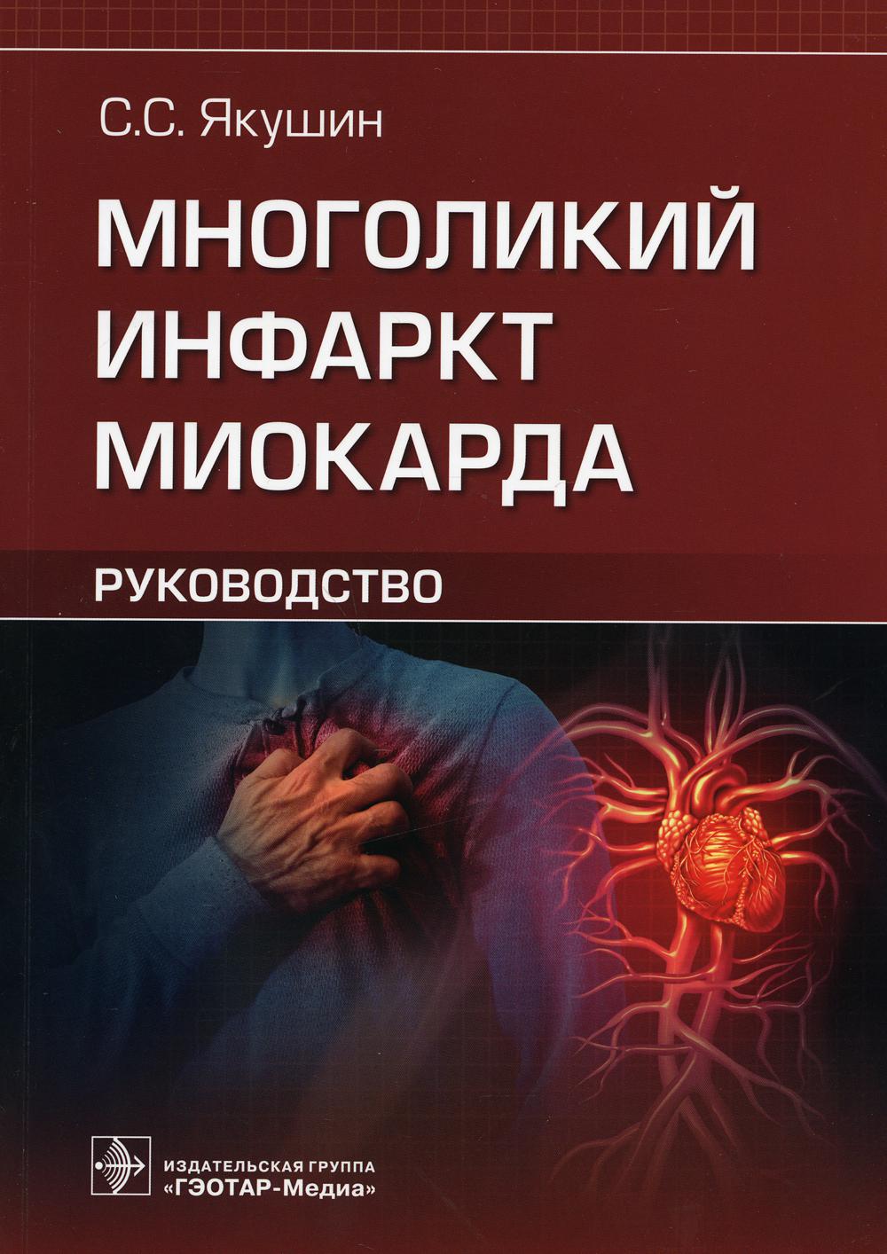 Многоликий инфаркт миокарда. Руководство