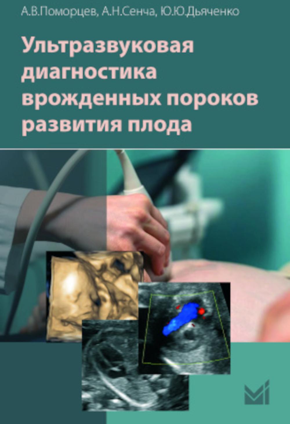 Ультразвуковая диагностика врожденных пороков развития плода