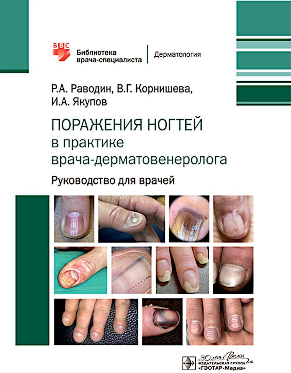 Поражения ногтей в практике врача-дерматовенеролога: руководство для врачей