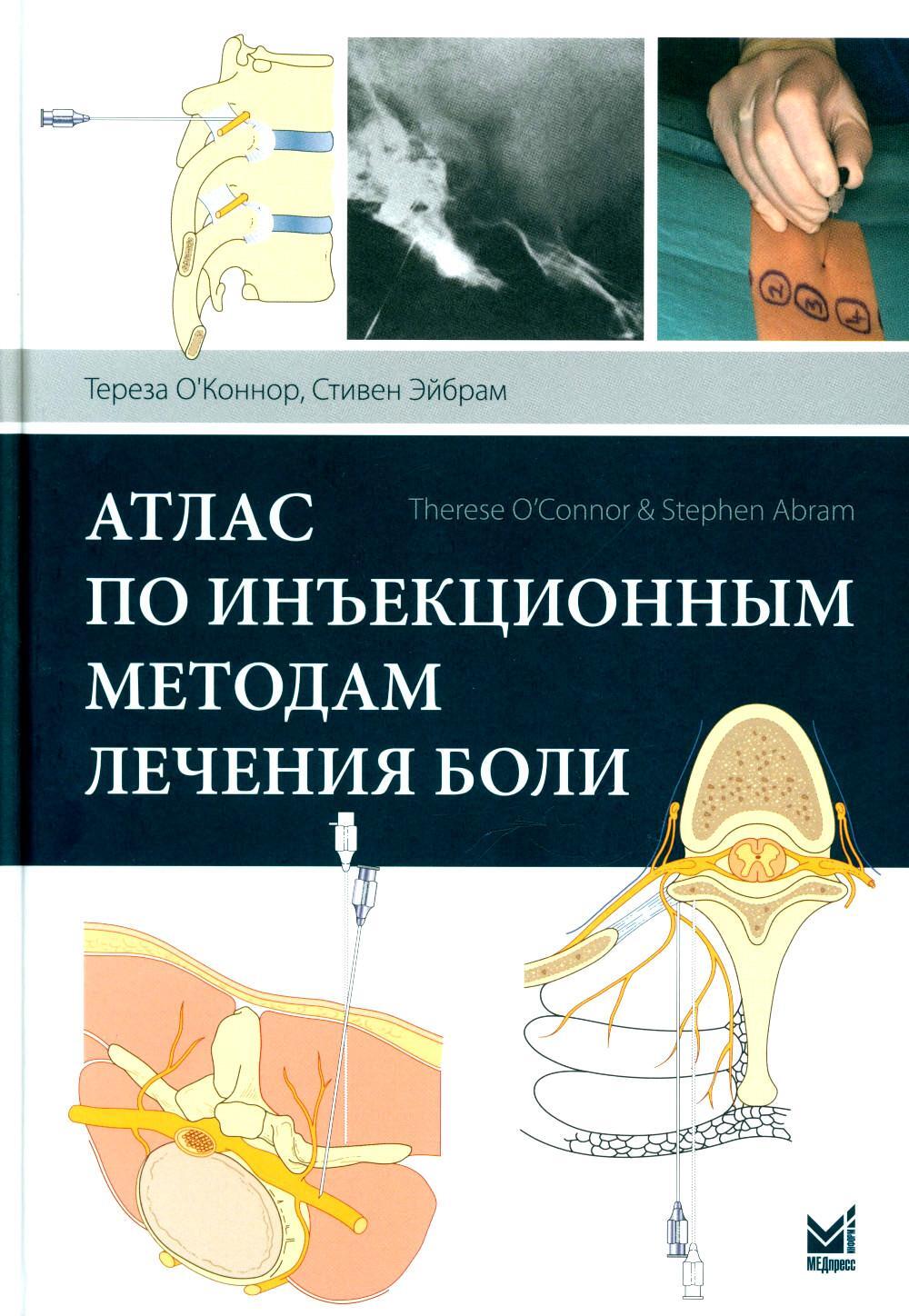 УЦЕНКА Атлас по инъекционным методам лечения боли. 2-е изд