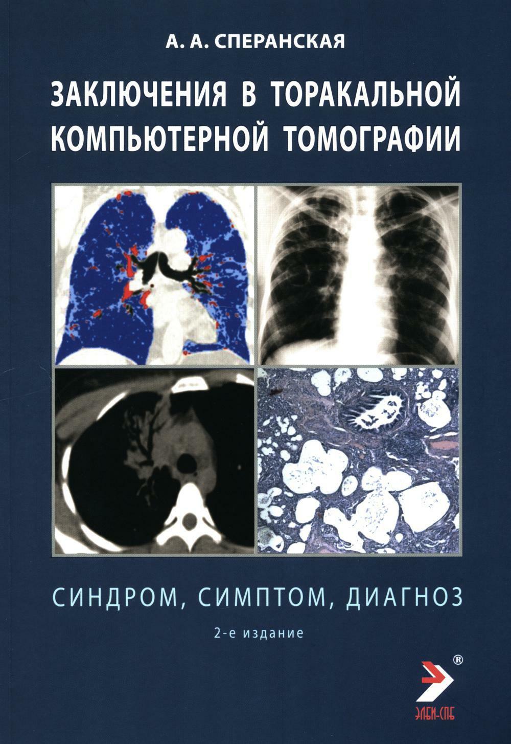Заключение в торакальной компьютерной томографии. Симптом, синдром, диагноз. 2-е изд