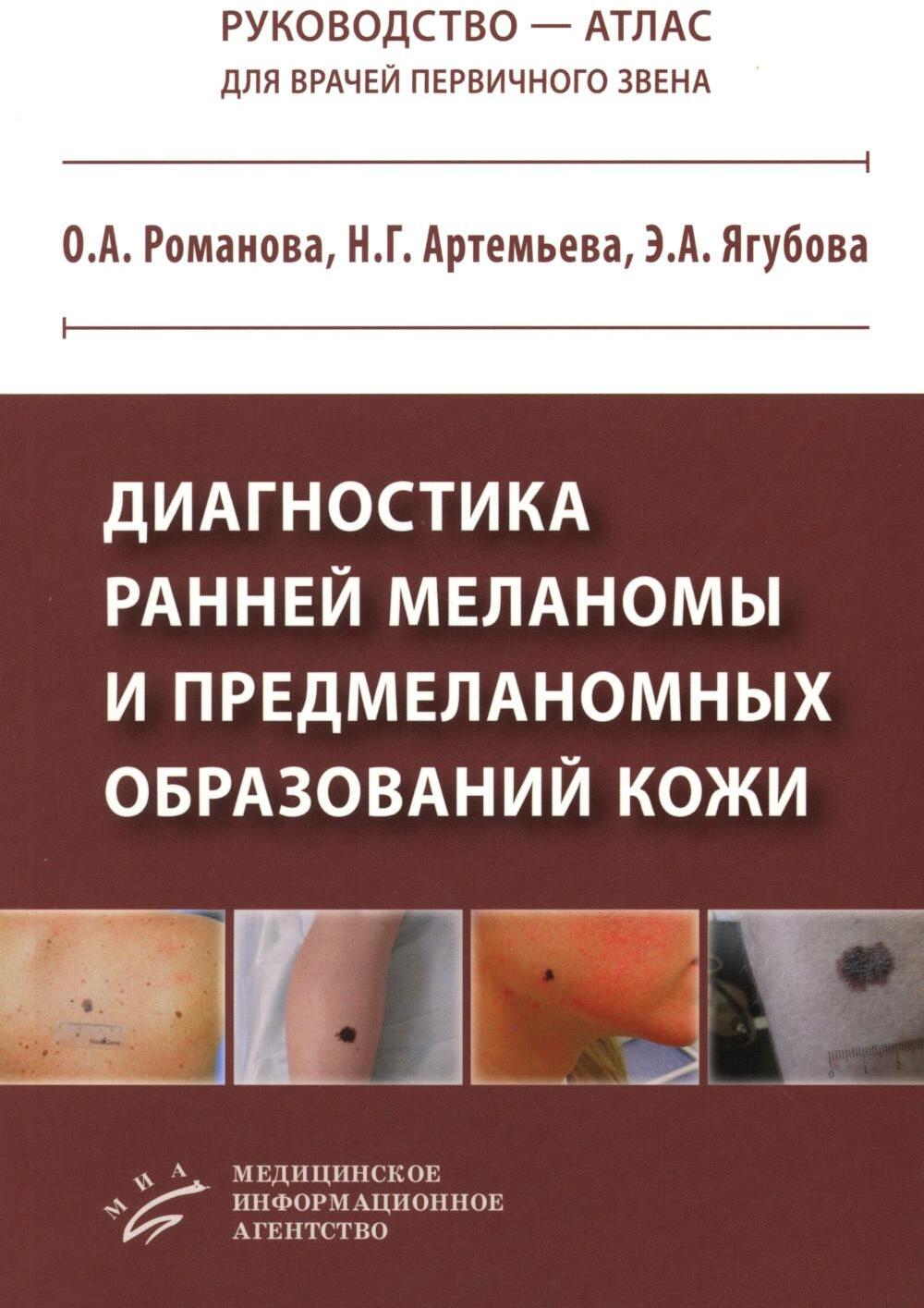 Диагностика ранней меланомы и предмеланомных образований кожи: Руководство - атлас для врачей первичного звена