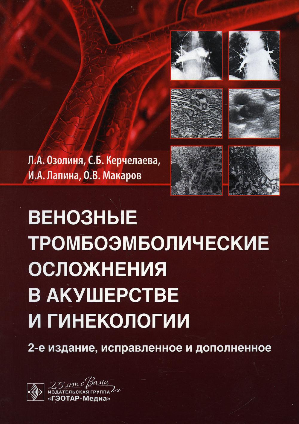 Венозные тромбоэмболические осложнения в акушерстве и гинекологии. 2-е изд., испр. и доп