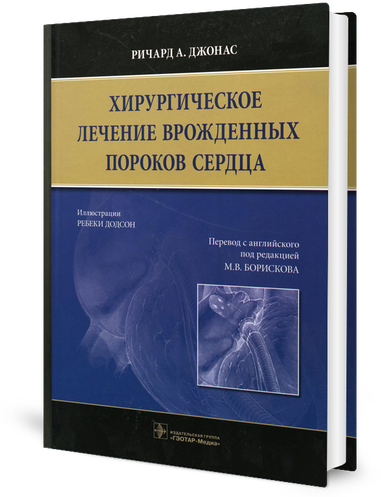 Хирургическое лечение врожденных пороков сердца