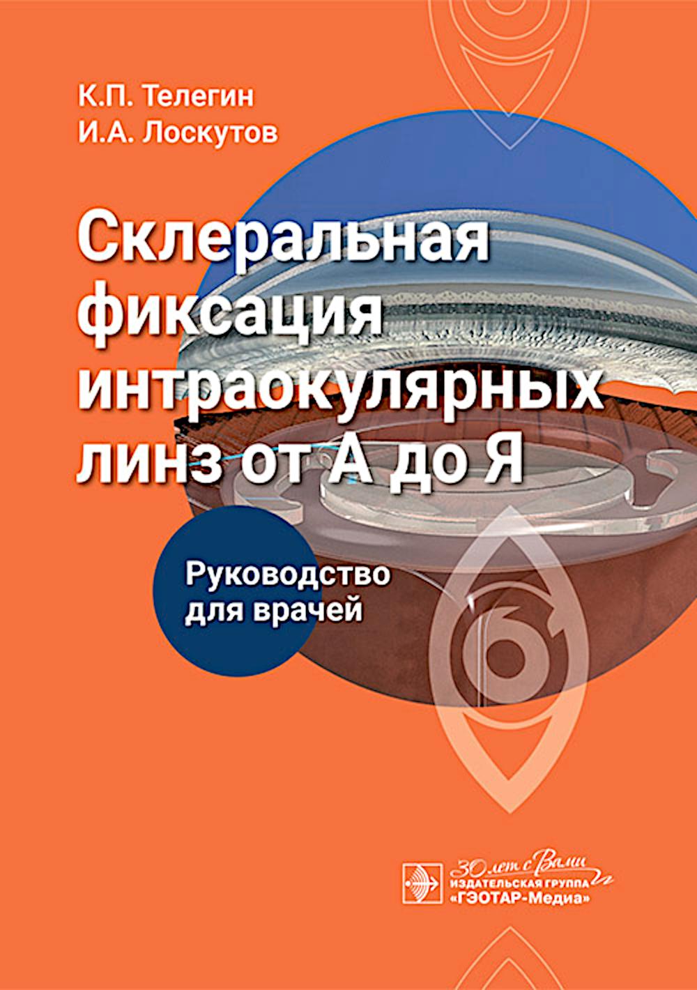 Склеральная фиксация интраокулярных линз от А до Я : руководство для врачей