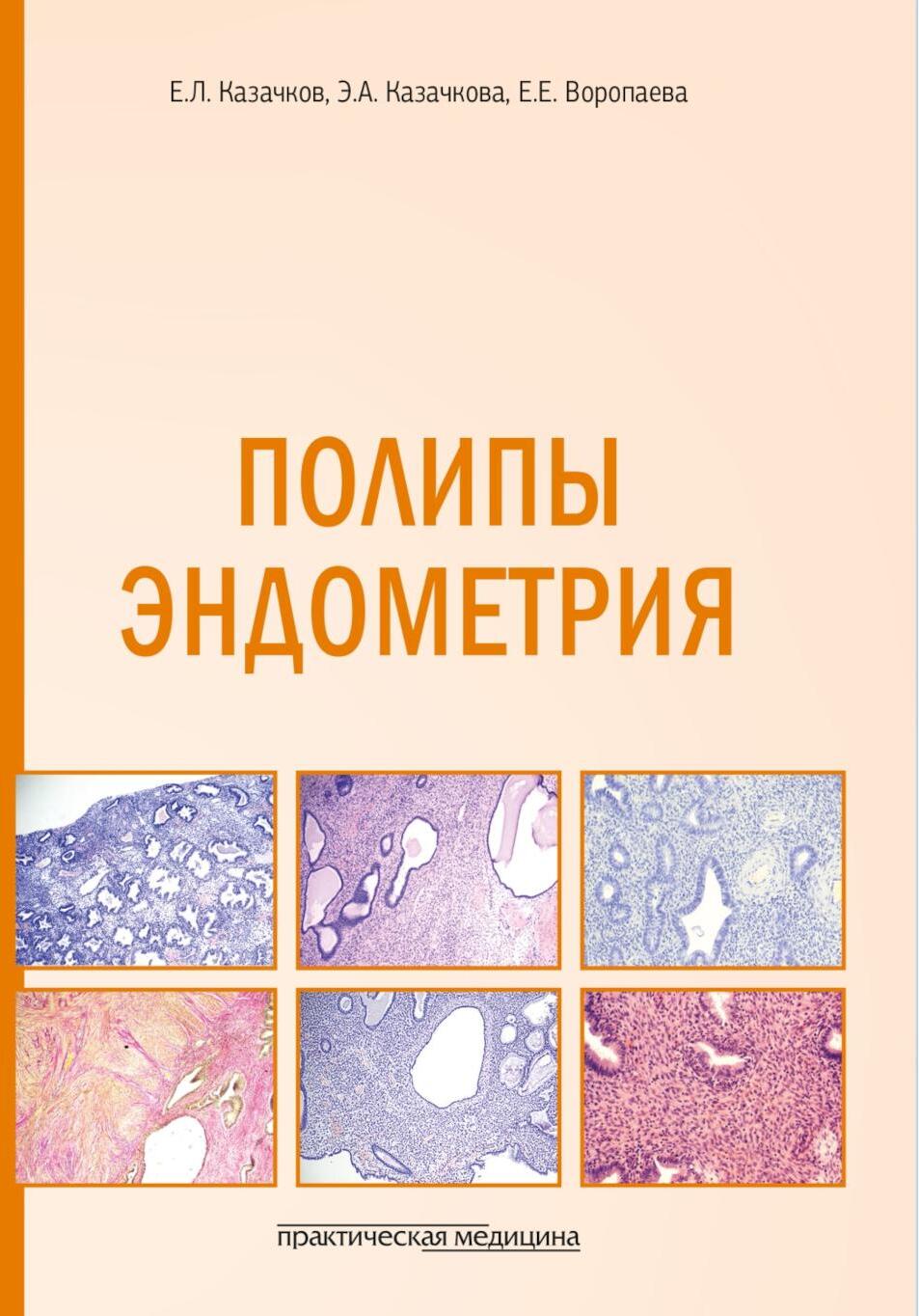 Полипы эндометрия: Учебное пособие