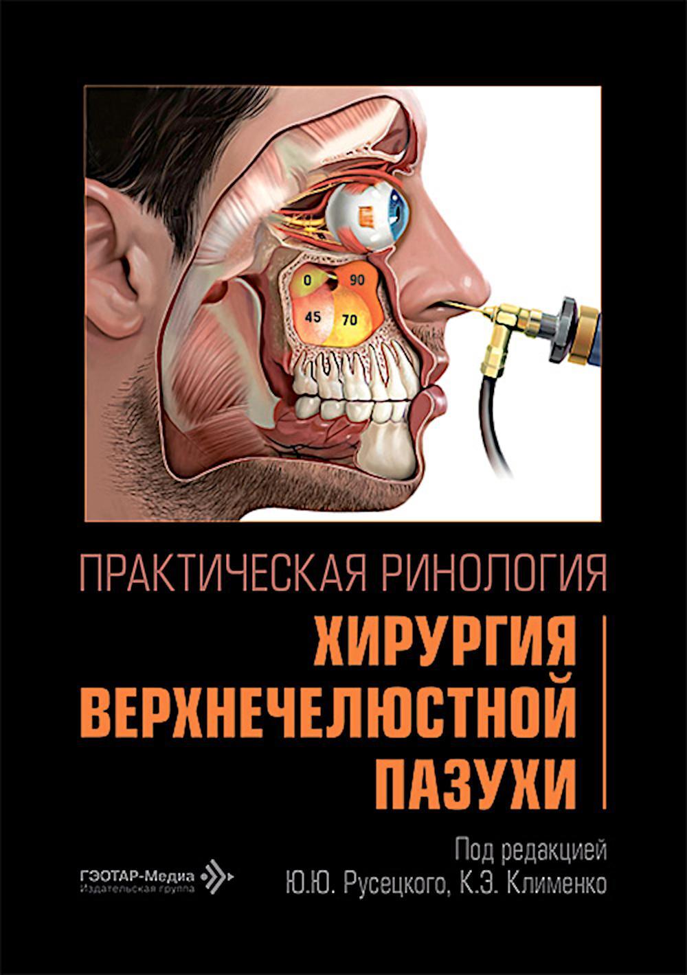 Практическая ринология: хирургия верхнечелюстной пазухи
