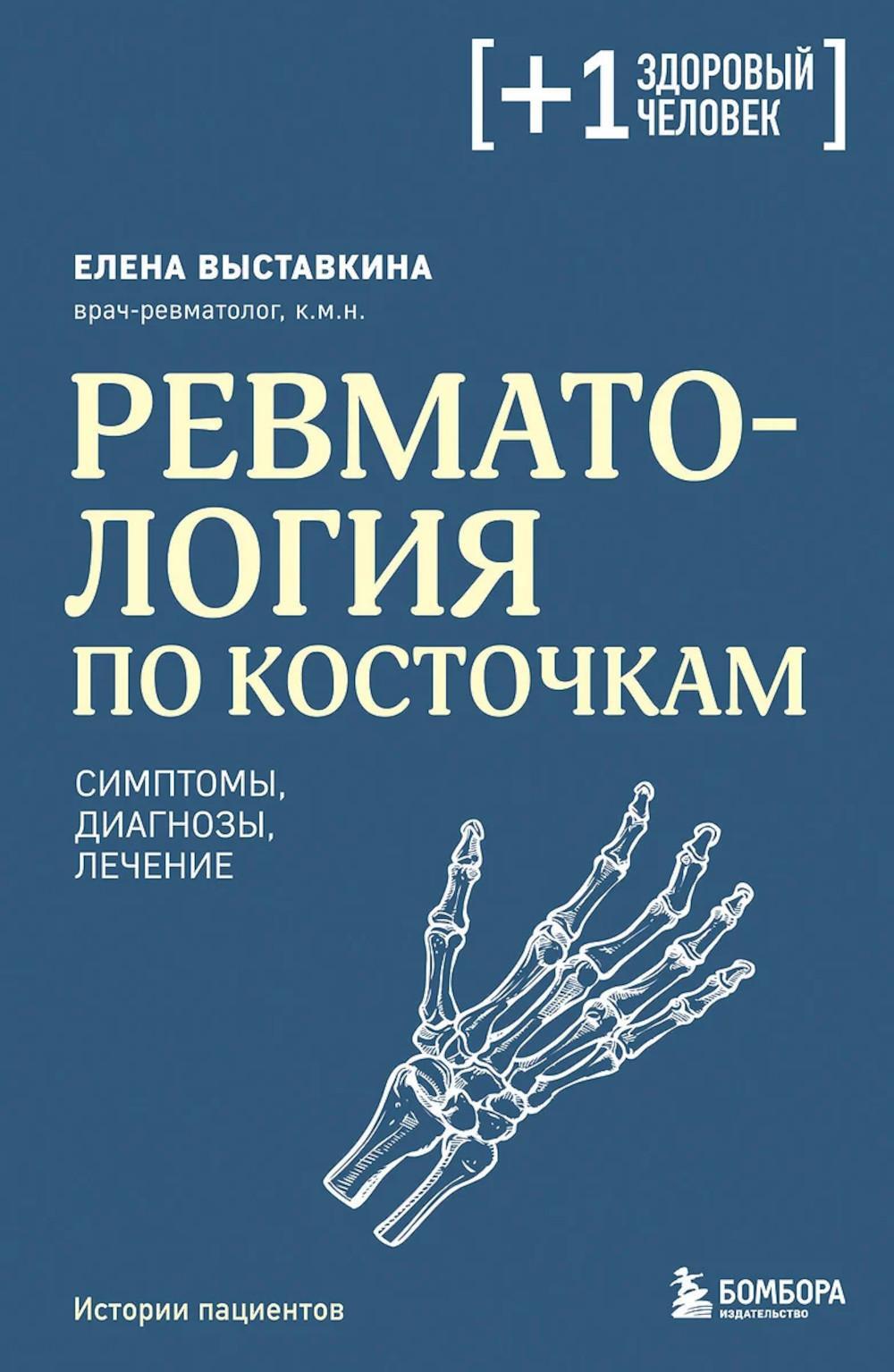 Ревматология по косточкам: симптомы, диагнозы, лечение