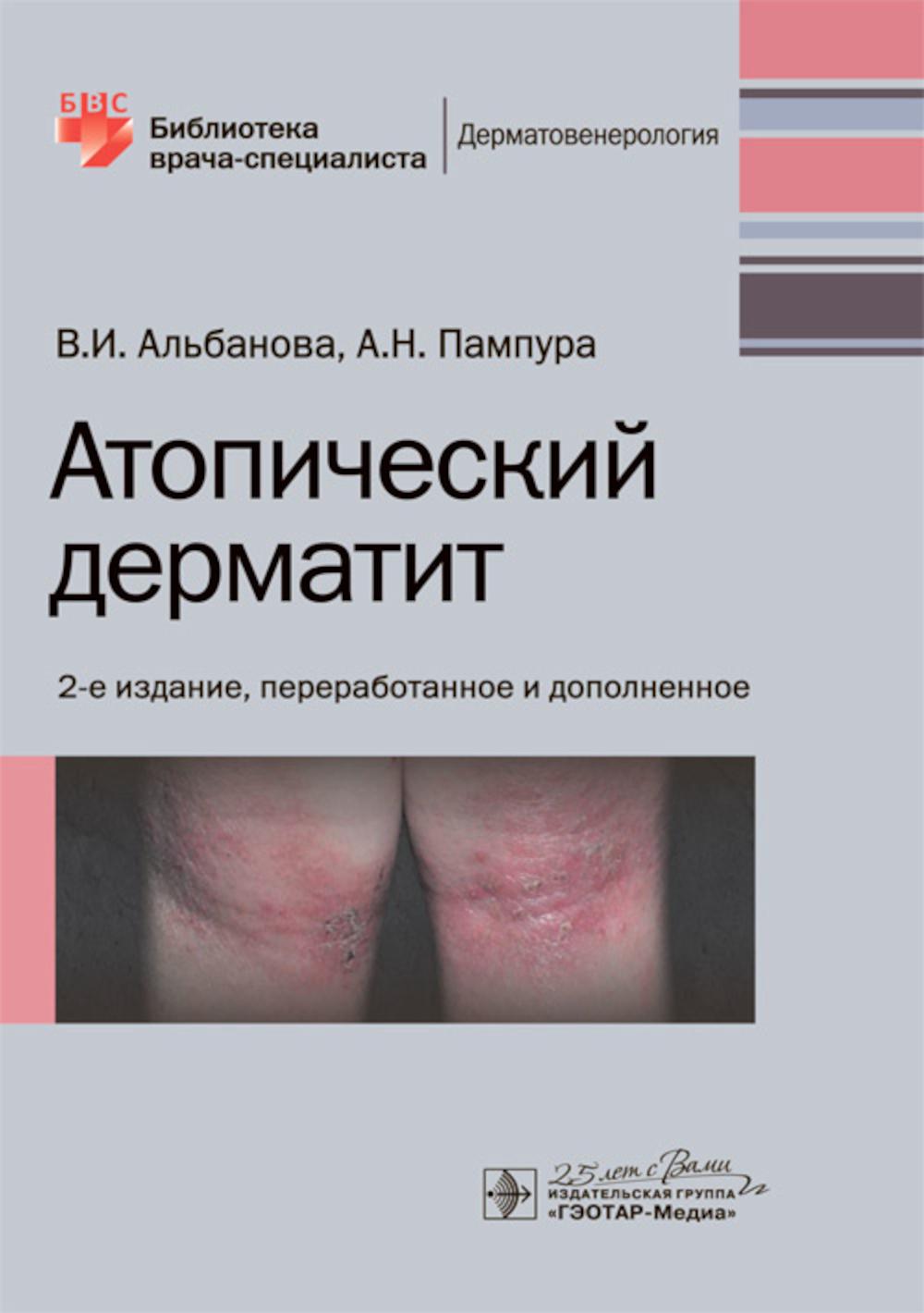 Атопический дерматит. 2-е изд., перераб. и доп