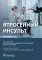 Ятрогенный инсульт: руководство для врачей