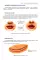 Простые местные лоскуты
